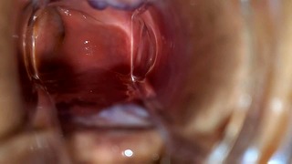 Bbw Hard Core Anal and Asshole Speculum Gape